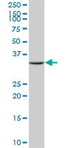 Anti-MPST antibody (ab70201) at 1/500 dilution + human liver tissue lysate at 25 µgSecondaryGoat Anti-Mouse IgG (H&L)-HRP Conjugate at 1/2500 dilution