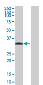 All lanes : Anti-MPST antibody (ab70201) at 1/500 dilutionLane 1 : MPST transfected 293T cell lysateLane 2 : Non-transfected 293T cell lysateLysates/proteins at 25 µg per lane.SecondaryGoat Anti-Mouse IgG (H&L)-HRP Conjugate at 1/2500 dilution