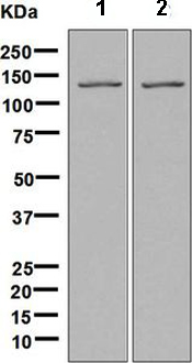 All lanes : Anti-HIV TAT specific factor 1 antibody [EPR9105(B)] (ab134921) at 1/1000 dilutionLane 1 : HeLa cell lysateLane 2 : Jurkat cell lysateLysates/proteins at 10 µg per lane.SecondaryGoat-anti-rabbit HRP at 1/2000 dilutiondeveloped using the ECL technique