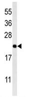 Anti-MRAP antibody (ab103319) at 1/100 dilution + 293 cell lysate at 35 µg