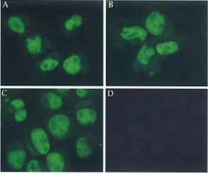 Indirect immunofluorescence to detect localisation of Mre11 in normal lymphoblastoid cells. (Panel D - negative control). 
