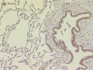 ab214 at 1/200 staining normal human bronchus tissue sections by IHC-P. The tissue was formaldehyde fixed and a heat mediated antigen retrieval step in EDTA was peformed. The tissue was blocked in normal rabbit serum and then incubated with the antibody for 1 hour. An HRP conjugated goat polyclonal antibody was used as the secondary.See Abreview