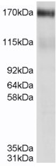 Anti-MRP4 antibody (ab77184) at 0.5 µg/ml + rat renal cortex membranes at 20 µg