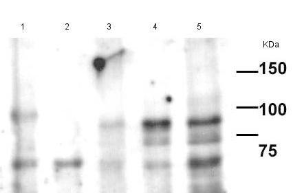 All lanes : Donkey Anti-Rabbit IgG H&L (Alexa Fluor® 568) (ab175470) at 1/100 dilutionLane 1 : Human kidney lysateLane 2 : Human colon lysateLane 3 : K562 cell lysateLane 4 : Daudi cell lysateLane 5 : Raji cell lysateLysates/proteins at 100 µg per lane.