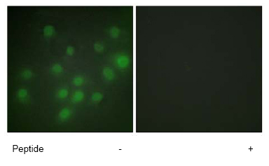 Immunofluorescence analysis of HUVEC cells using ab65010 at a 1:500 dilution.Left image untreated.Right image treated with peptide.
