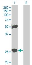 All lanes : Anti-MS4A3 antibody (ab68207) at 1/500 dilutionLane 1 : MS4A3 transfected 293T cell lysateLane 2 : Non transfected 293T cell lysateLysates/proteins at 25 µg per lane.SecondaryGoat Anti-Mouse IgG (H&L)-HRP Conjugate at 1/2500 dilution