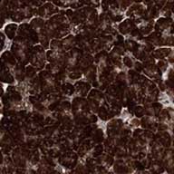 ab122502 at 1/50 dilution staining C11orf61 in Paraffin-embedded Human pancreas tissue by Immunohistochemistry.