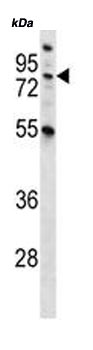 Anti-MST1 antibody - C-terminal (ab170767) at 1/100 dilution + NCI-H460 cell line lysate at 35 µgdeveloped using the ECL technique
