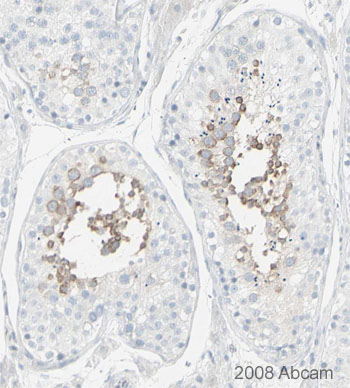 Image courtesy of Human Protein Atlasab33164 staining MSY2/YBOX2 in human testis tissue, showing staining in the seminiferous tubules. Paraffin embedded human skin tissue was incubated with ab33164 (1/200 dilution) for 30 mins at room temperature. Antigen retrieval was performed by heat induction in citrate buffer pH 6. ab33164 was tested in a tissue microarray (TMA) containing a wide range of normal and cancer tissues as well as a cell microarray consisting of a range of commonly used, well characterised human cell lines. Further results for this antibody can be found at www.proteinatlas.org