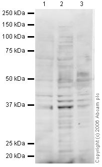 All lanes : Anti-MSY2/YBOX2 antibody (ab33164) at 1 µg/mlLane 1 : MEL-2 (Human embryonic stem cell, female cell line) Whole Cell Lysate (ab27196)Lane 2 : F9 (Mouse embryonic carcinoma cell line) Whole Cell Lysate (ab27193)Lane 3 : Embryonic Germ Cell LysateLysates/proteins at 20 µg per lane.SecondaryRabbit IgG secondary antibody (ab28446) at 1/10000 dilutionObserved band size : 37 kDa (why is the actual band size different from the predicted?)Additional bands at : 39 kDa (possible glycosylated form,post-translational modification),42 kDa (possible glycosylated form,post-translational modification).This antibody recognised a number of bands included 3 clustered around the YBOX2 predicted molecular weight of 38 kDa. We cannot be sure which of these bands, if any, corresponds to YBOX2. We are also unsure whether YBOX2 would be expected to be expressed at a detectable level for Western Blotting in the lysates tested.