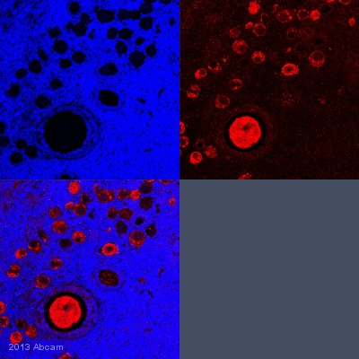 IHC-P image of MSY2/YBOX2 staining with ab33164 on tissue sections from adult marmoset ovary. The sections were subjected to heat-mediated antigen retrieval using Dako antigen retrieval solution. The sections were then blocked with 5% milk for 30 minutes at 25°C, before incubation with ab33164 (1/100 dilution) for 18 hours at 4°C. The secondary was an Alexa-Fluor 555 conjugated goat anti-rabbit polyclonal, used at a 1/500 dilution.See Abreview