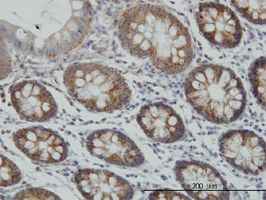MT antibody (ab57287) used in immunohistochemistry at 3ug/ml on formalin fixed and paraffin embedded human colon.
