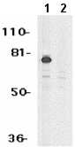 All lanes : Anti-MTA2 antibody (ab8106) at 1 µg/mlLane 1 : HeLa whole cell lysate with absence of blocking peptideLane 2 : HeLa whole cell lysate with presence of blocking peptide