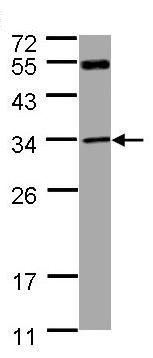 Anti-MTAP antibody (ab96231) at 1/1000 dilution + A431 whole cell lysate at 30 µg
