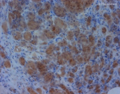 ab96231 staining MTAP in human pancreas tissue sections by Immunohistochemistry (IHC-P - paraformaldehyde-fixed, paraffin-embedded sections). Tissue was fixed with paraformaldehyde and permeabilized; antigen retrieval was by heat mediation in Tris-EDTA buffer, pH 8.5. Samples were incubated with primary antibody (1/500) for 30 minutes at 20°C. An undiluted HRP-conjugated goat anti-rabbit IgG polyclonal was used as the secondary antibody.See Abreview