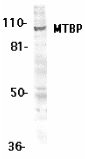 Anti-MTBP antibody (ab8107) at 1 µg/ml + K562 whole cell lysate