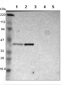 All lanes : Anti-MTERFD1 antibody (ab121156) at 1/250 dilutionLane 1 : RT4 cell lysateLane 2 : U251 MG cell lysateLane 3 : Human plasmaLane 4 : Liver lysateLane 5 : Tonsil lysatedeveloped using the ECL technique