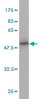 Western blot against tagged recombinant protein immunogen using ab55527 MTH1 antibody at 1ug/ml.