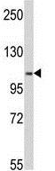 Anti-MTHFD1 antibody (ab174237) at 1/50 dilution + Y79 cell lysate at 35 µg