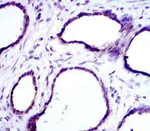 Immunohistochemical analysis of paraffin-embedded human prostate tissues using 1/200 ab113637 with DAB staining.