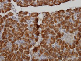 MTM1 antibody (ab55532) used in immunohistochemistry at 3ug/ml on formalin fixed and paraffin embedded human pancreas.