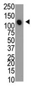 Anti-MTMR4 antibody (ab60151) at 1/500 dilution + Mouse heart cell lysate