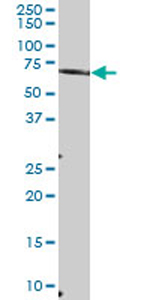Anti-MTMR6 antibody (ab69875) at 1/500 dilution + human kidney tissue lysate at 50 µgSecondaryGoat Anti-Mouse IgG (H&L)-HRP Conjugate at 1/2500 dilution