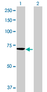 All lanes : Anti-MTMR6 antibody (ab69875) at 1/500 dilutionLane 1 : MTMR6 transfected 293T cell lysateLane 2 : Non-transfected 293T cell lysateLysates/proteins at 25 µg per lane.SecondaryGoat Anti-Mouse IgG (H&L)-HRP Conjugate at 1/2500 dilution