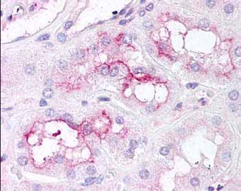 ab1093 at 5 µg/ml staining proximal convulted tubules of the kidney.  The image shows localization of the antibody as the precipitated red signal, with a hematoxylin purple nuclear counterstain.