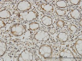 MTSS1 antibody (ab56780) used in immunohistochemistry at 3ug/ml on formalin fixed and paraffin embedded human colon.