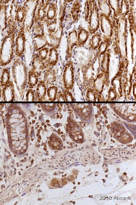 IHC-P image of mtTFA staining using ab47517 in kidney (upper) and Colon (lower) sections. The tissue was fixed using formaldehyde. Heat mediated epitope retrieval was carried out using citric acid (pH 6). The sections were blocked uwing 1% BSA for 10 mins at 21°C.See Abreview