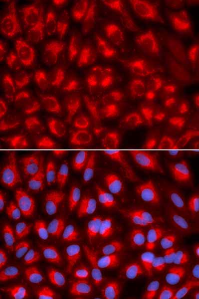 Immunocytochemistry/Immunofluorescence analysis of U2OS cells using ab180763. Blue DAPI for nuclear staining.