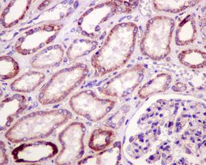 Immunohistochemical analysis of formalin-fixed, paraffin-embedded Human kidney tissue, labeling mtTFA using ab176558 at a 1/50 dilution.