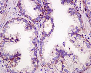 Immunohistochemical analysis of formalin-fixed, paraffin-embedded Human prostate tissue, labeling mtTFA using ab176558 at a 1/50 dilution.