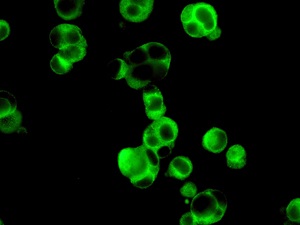 Immunofluorescent analysis of OVCAR-3 cells labelling MUC16 with ab134093 at 1/100 dilution.