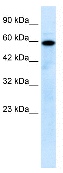 Anti-Mucolipin 1 antibody (ab28508) at 0.5 µg/ml + Jurkat cell lysateSecondaryRabbit Anti mucolipin 1 at 1/50000 dilution