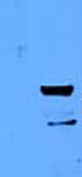 All lanes : Anti-MUM1 antibody (ab52713) at 1/1000 dilutionLane 1 : ~20µg of a total protein extract from E coli with ~50ng to 100ng of a tagged fusion protein of an irrelevant antigen Lane 2 : ~20µg of a total protein extract from E coli with ~50ng to 500ng of the antigen (tagged antigen fusion protein)SecondaryRabbit anti-mouse IgG + IgM, (H+L) horseradish peroxidase conjugated at 1/5000 dilution
