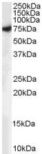 Anti-Munc18-1 antibody (ab52011) at 0.1 µg/ml + Human Brain lysate (35µg protein in RIPA buffer)