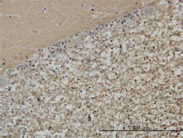 Munc18 antibody (ab57847) used in immunohistochemistry at 3ug/ml on formalin fixed and paraffin embedded human cerebellum.