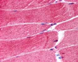 ab4125 at 1.25 µg/ml staining human skeletal muscle by IHC-P.  Tissue sections were subjected to steamed antigen retrieval with citrate buffer (pH6), AP-staining.  Shows strong staining in rare nuclei, and weak staining of muscle fibres in longitudinal section.