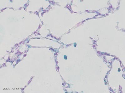 ab4125 staining MURF1 in mouse lung tissue section by Immunohistochemistry (Frozen sections). Tissue underwent fixation in paraformaldehyde and blocked in 1%BSA for 10 minutes at 20°C. The primary antibody was diluted 1/200 and incubated with sample for 20 hours at 20°C. A Biotin conjugated rabbit polyclonal to goat IgG, diluted 1/500 was used as secondary.See Abreview