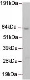 Anti-Mus81 antibody [MTA30 2G10/3] (ab14387) at 1/1000 dilution + HeLa cell lysate
