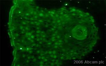 ab21628 at 1ug/ml staining human eye (limbal region) by ICC/IF. The cells were paraformaldehyde fixed and blocked with 2% BSA prior to incubation with antibody for 1 hour. A FITC conjugated sheep polyclonal antibody was used as the secondary.See Abreview