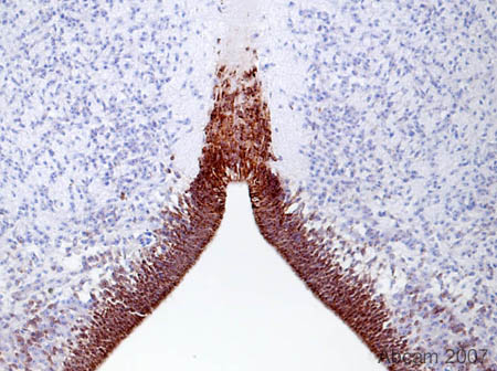 Immunohistochemistical detection (on formaldehyde/PFA-fixed paraffin-embedded sections) of Musashi 1 / Msi1 antibody [EP1302] (ab52865) on Quail Tissue sections (embryo d5/6 Brain stem T/S). Antigen retrieval step: Heat mediated. Blocking step: 1% BSA for 10 mins at RT. Primary Antibody ab52865 incubated at 1/300 for 2 hours at RT. Secondary Antibody: Biotin labelled goat anti rabbit IgG (1/300).