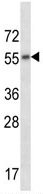 Anti-Muscarinic Acetylcholine Receptor 2 antibody (ab123421) at 1/100 dilution + CEM cell line lysate at 35 µg