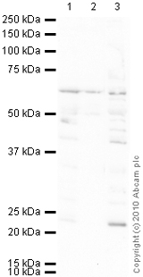 All lanes : Anti-Muscarinic Acetylcholine Receptor 2 antibody [31-1D1] (ab2805) at 1 µg/mlLane 1 : Brain (Human) Tissue Lysate - adult normal tissue (ab29466)Lane 2 : Spinal Cord (Human) Tissue Lysate - adult normal tissue (ab29188)Lane 3 : Brain (Mouse) Tissue Lysate Lysates/proteins at 10 µg per lane.SecondaryGoat Anti-Mouse IgG H&L (HRP) preadsorbed (ab97040) at 1/5000 dilutiondeveloped using the ECL techniquePerformed under reducing conditions.