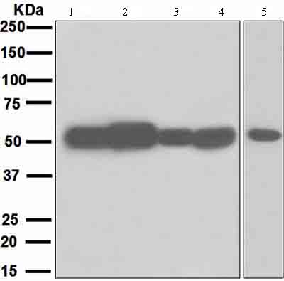 All lanes : Anti-Muscarinic Acetylcholine Receptor 2 antibody [EPR4568] (ab109226) at 1/1000 dilutionLane 1 : SH-SY5Y lysateLane 2 : Fetal brain lysateLane 3 : U87-MG lysateLane 4 : Neuro-2a lysateLane 5 : Y79 lysates Lysates/proteins at 10 µg per lane.SecondaryStandard HRP labelled goat anti-rabbit at 1/2000 dilution