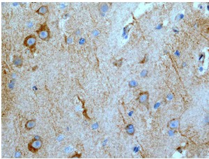 Immunohistochemical analysis of paraffin-embedded Human brain tissue using ab109226 at 1/100.