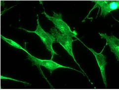 Immunofluorescent staining of SH-SY5Y cells using ab109226 at 1/100.