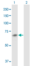 All lanes : Anti-Muscarinic Acetylcholine Receptor M5 antibody (ab167567) at 1 µg/mlLane 1 : Muscarinic Acetylcholine Receptor M5 transfected 293T cell lysateLane 2 : Non-transfected 293T cell lysateLysates/proteins at 15 µl per lane.SecondaryGoat Anti-Mouse IgG (H&L)-HRP at 1/2500 dilution